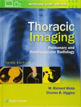 Imagem de Thoracic Imaging: Thoracic Imaging Pulmonary and Cardiovascular Radiology