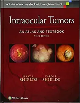 Imagem de Intraocular Tumors: An Atlas and Textbook