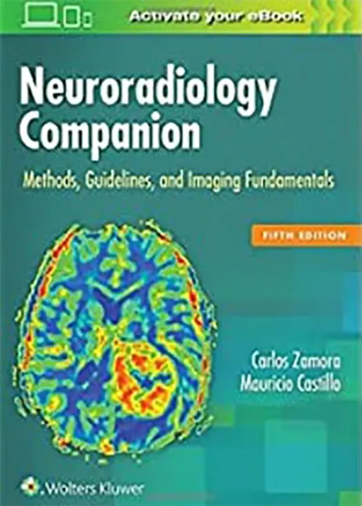 Imagem de Neuroradiology Companion: Methods, Guidelines, and Imaging Fundamentals