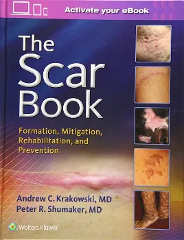 Imagem de The Scar Book: Formation, Mitigation, Rehabilitation and Prevention