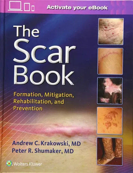Imagem de The Scar Book: Formation, Mitigation, Rehabilitation and Prevention