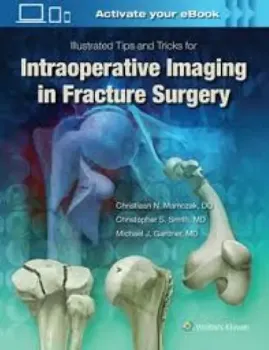 Picture of Book Illustrated Tips and Tricks for Intraoperative Imaging in Fracture Surgery