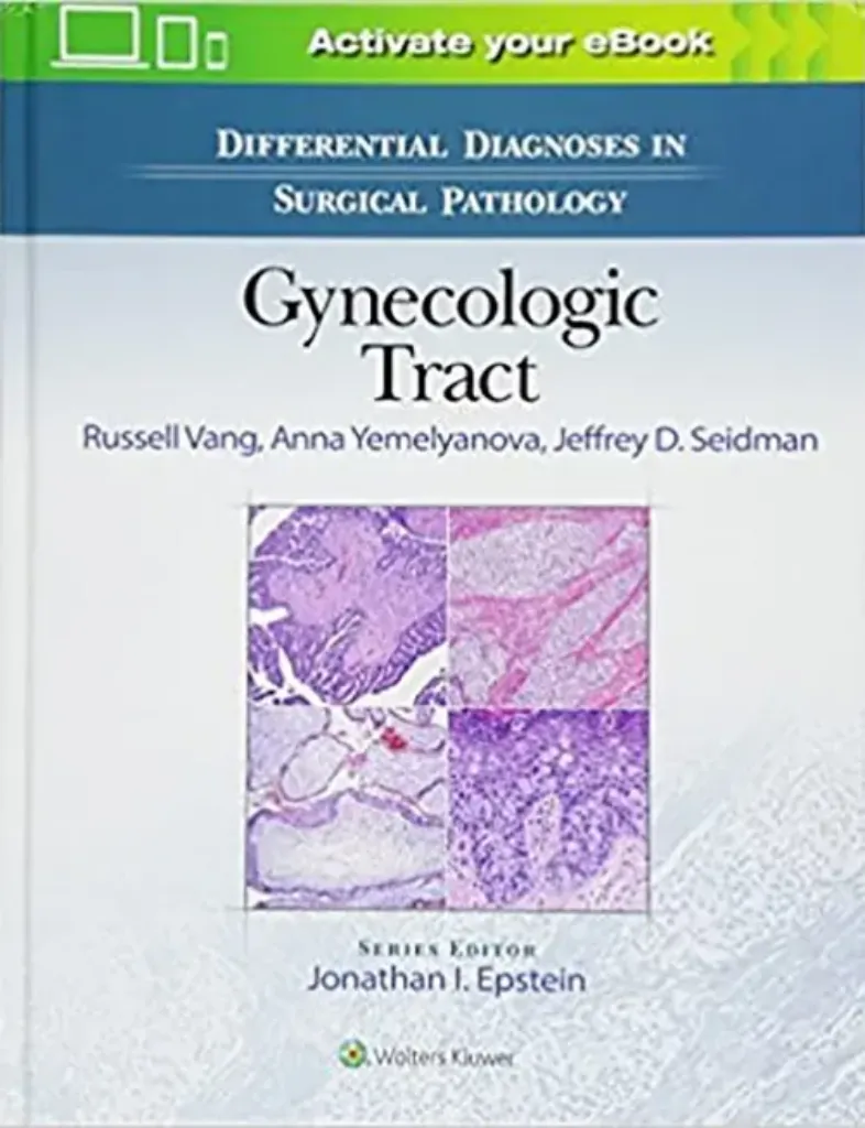 Imagem de Differential Diagnoses in Surgical Pathology: Gynecologic Tract