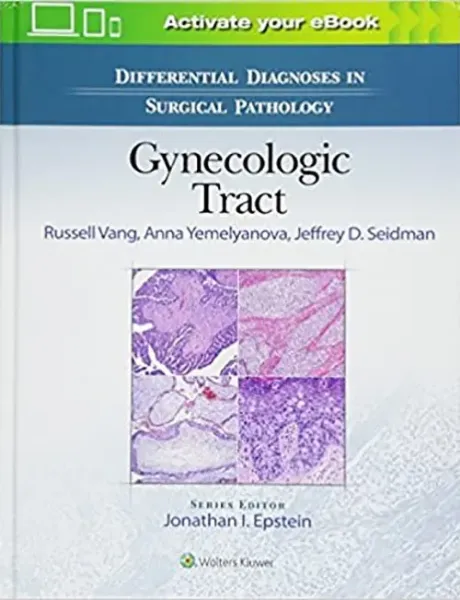 Imagem de Differential Diagnoses in Surgical Pathology: Gynecologic Tract