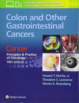 Imagem de Colon and Other Gastrointestinal Cancers: Cancer: Principles & Practice of Oncology