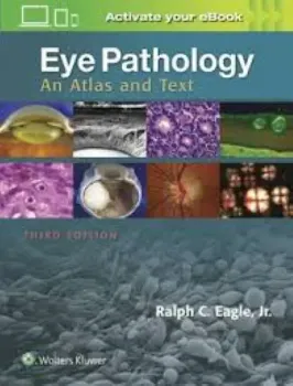 Picture of Book Eye Pathology: An Atlas and Text