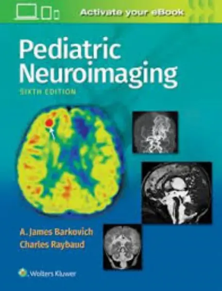Imagem de Pediatric Neuroimaging