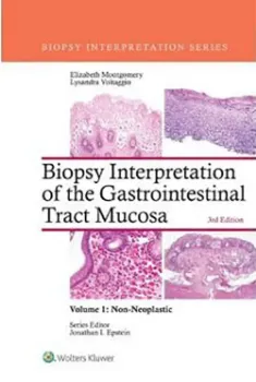 Imagem de Biopsy Interpretation of the Gastrointestinal Tract Mucosa: Vol. 1: Non-Neoplastic