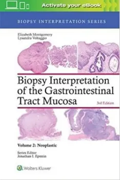 Picture of Book Biopsy Interpretation of the Gastrointestinal Tract Mucosa: Neoplastic Vol. 2