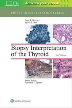 Imagem de Biopsy Interpretation of the Thyroid