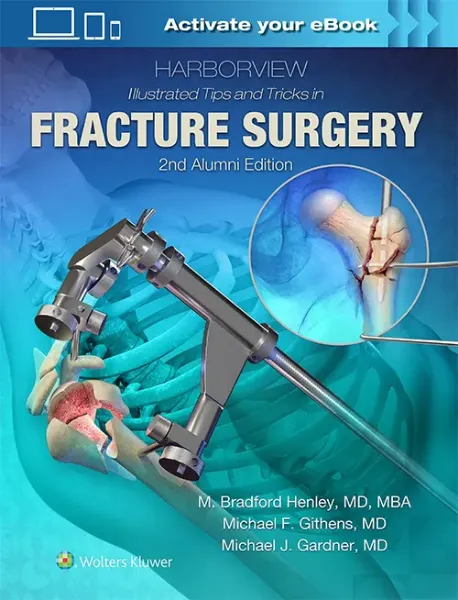 Imagem de Harborview Illustrated Tips and Tricks in Fracture Surgery
