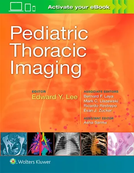 Imagem de Pediatric Thoracic Imaging
