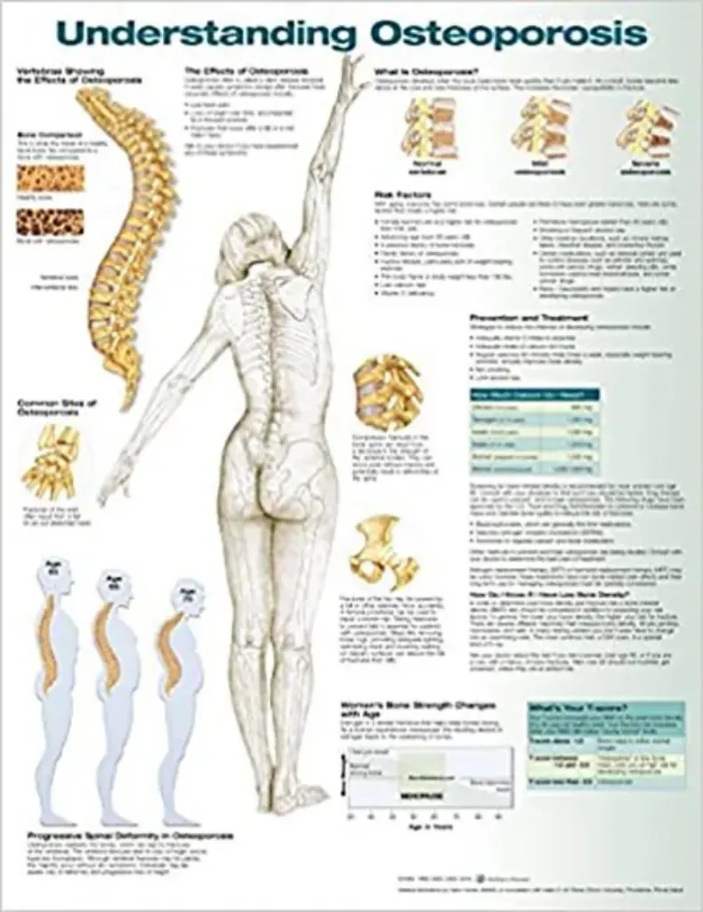 Imagem de Understanding Osteoporosis