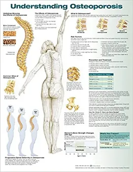 Imagem de Understanding Osteoporosis