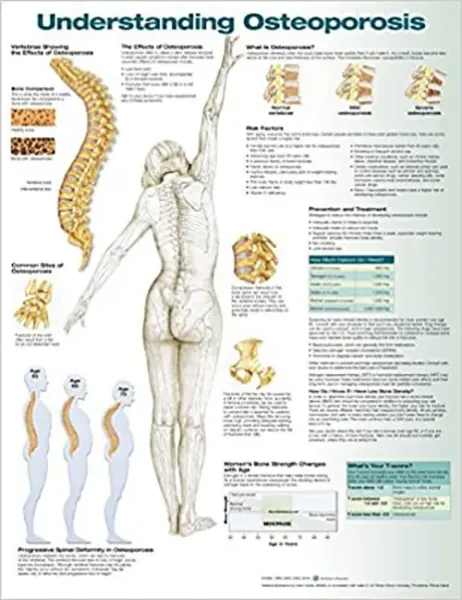 Imagem de Understanding Osteoporosis