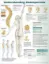 Picture of Book Understanding Osteoporosis