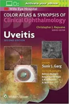 Imagem de Uveitis - Color Atlas and Synopsis of Clinical Ophthalmology