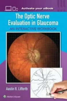 Picture of Book The Optic Nerve Evaluation in Glaucoma: An Interactive Workbook