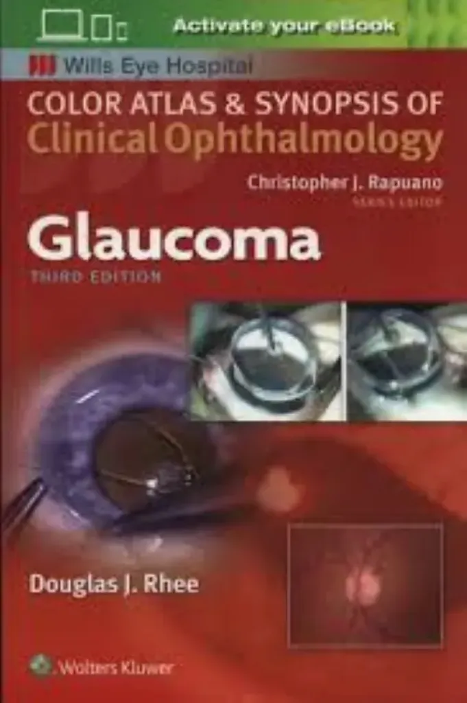 Imagem de Glaucoma - Color Atlas and Synopsis of Clinical Ophthalmology