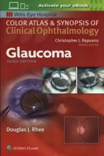 Imagem de Glaucoma - Color Atlas and Synopsis of Clinical Ophthalmology