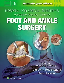 Imagem de Hospital for Special Surgery's Illustrated Tips and Tricks in Foot and Ankle Surgery