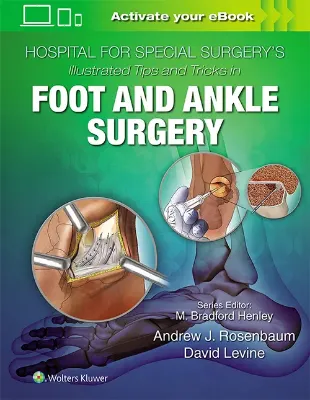 Imagem de Hospital for Special Surgery's Illustrated Tips and Tricks in Foot and Ankle Surgery