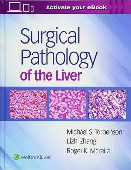 Imagem de Surgical Pathology of the Liver