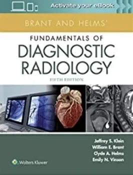 Imagem de Brant and Helms' Fundamentals of Diagnostic Radiology