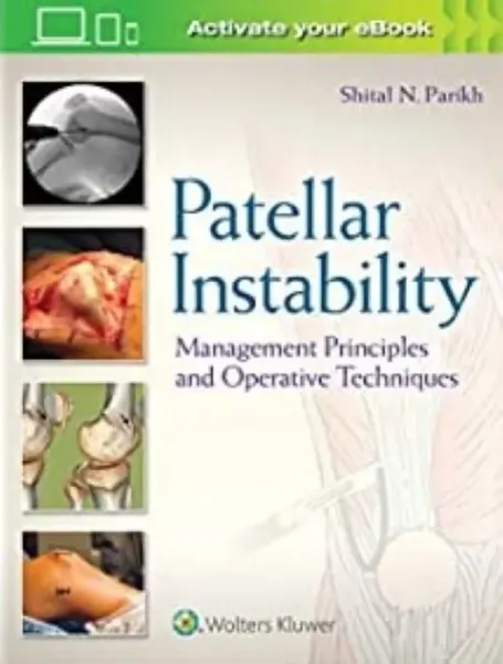 Imagem de Patellar Instability