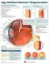 Imagem de Age-Related Macular Degeneration Anatomical Chart