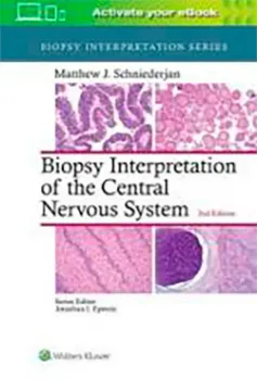 Imagem de Biopsy Interpretation of the Central Nervous System