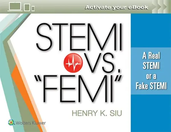 Imagem de STEMI vs. “FEMI”: A Real STEMI or a Fake STEMI