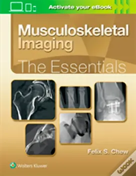 Imagem de Musculoskeletal Imaging: The Essentials