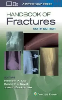Imagem de Handbook of Fractures