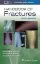 Picture of Book Handbook of Fractures