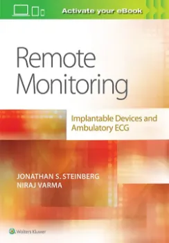 Imagem de Remote Monitoring: implantable Devices and Ambulatory ECG