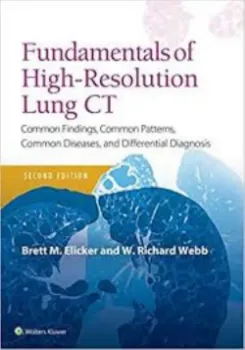 Picture of Book Fundamentals of High-Resolution Lung CT