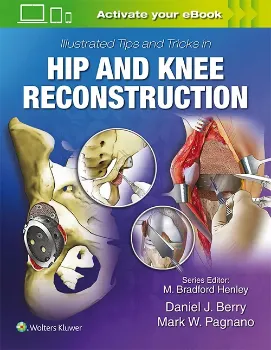 Picture of Book Illustrated Tips and Tricks in Hip and Knee Reconstructive and Replacement Surgery