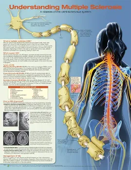Picture of Book Understanding Multiple Sclerosis