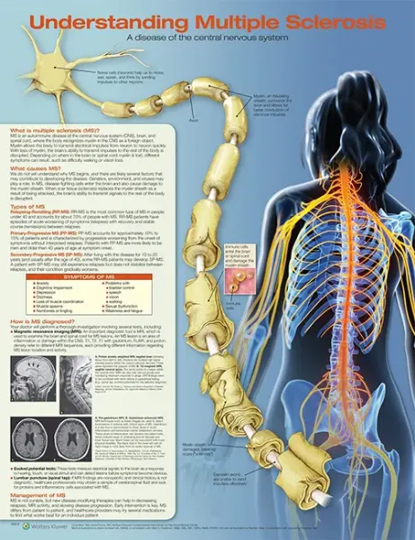 Imagem de Understanding Multiple Sclerosis