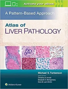 Picture of Book Atlas of Liver Pathology: A Pattern-Based Approach