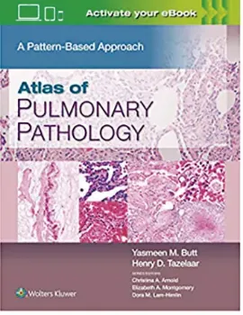 Picture of Book Atlas of Pulmonary Pathology