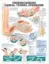 Picture of Book Understanding Carpal Tunnel Syndrome Anatomical Chart