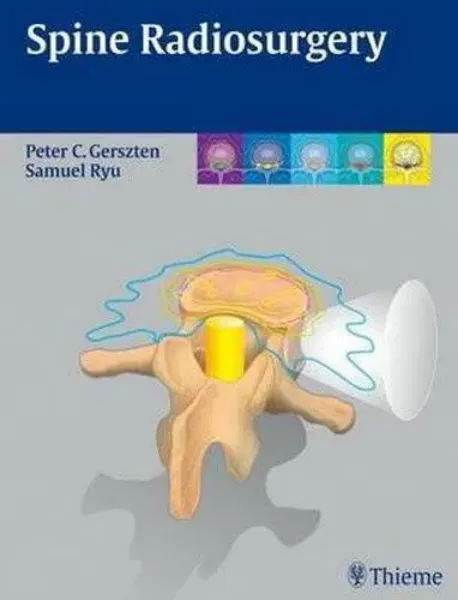 Imagem de Spine Radiosurgery