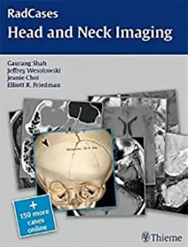 Picture of Book RadCases Head and Neck Imaging