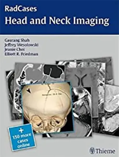 Imagem de RadCases Head and Neck Imaging