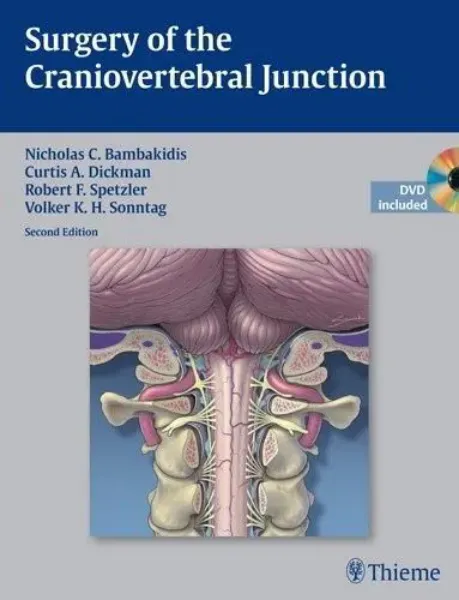 Imagem de Surgery of the Craniovertebral Junction