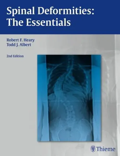 Imagem de Spinal Deformities: The Essentials