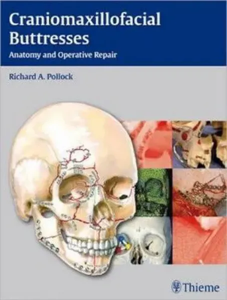 Imagem de Craniomaxillofacial Buttresses