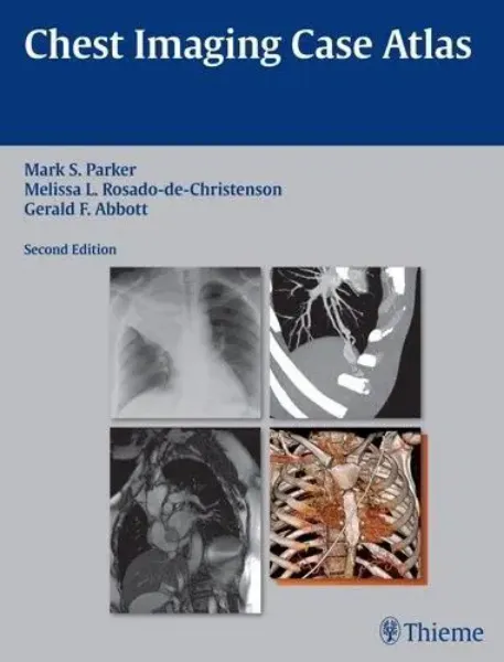 Imagem de Chest Imaging Case Atlas
